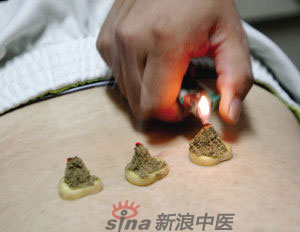灸法的種類(lèi)  你知道多少？