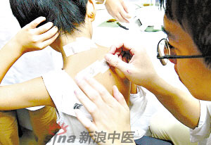 灸法的種類(lèi)  你知道多少？